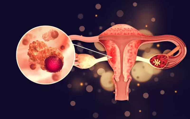 female-genito-urinary-cancer